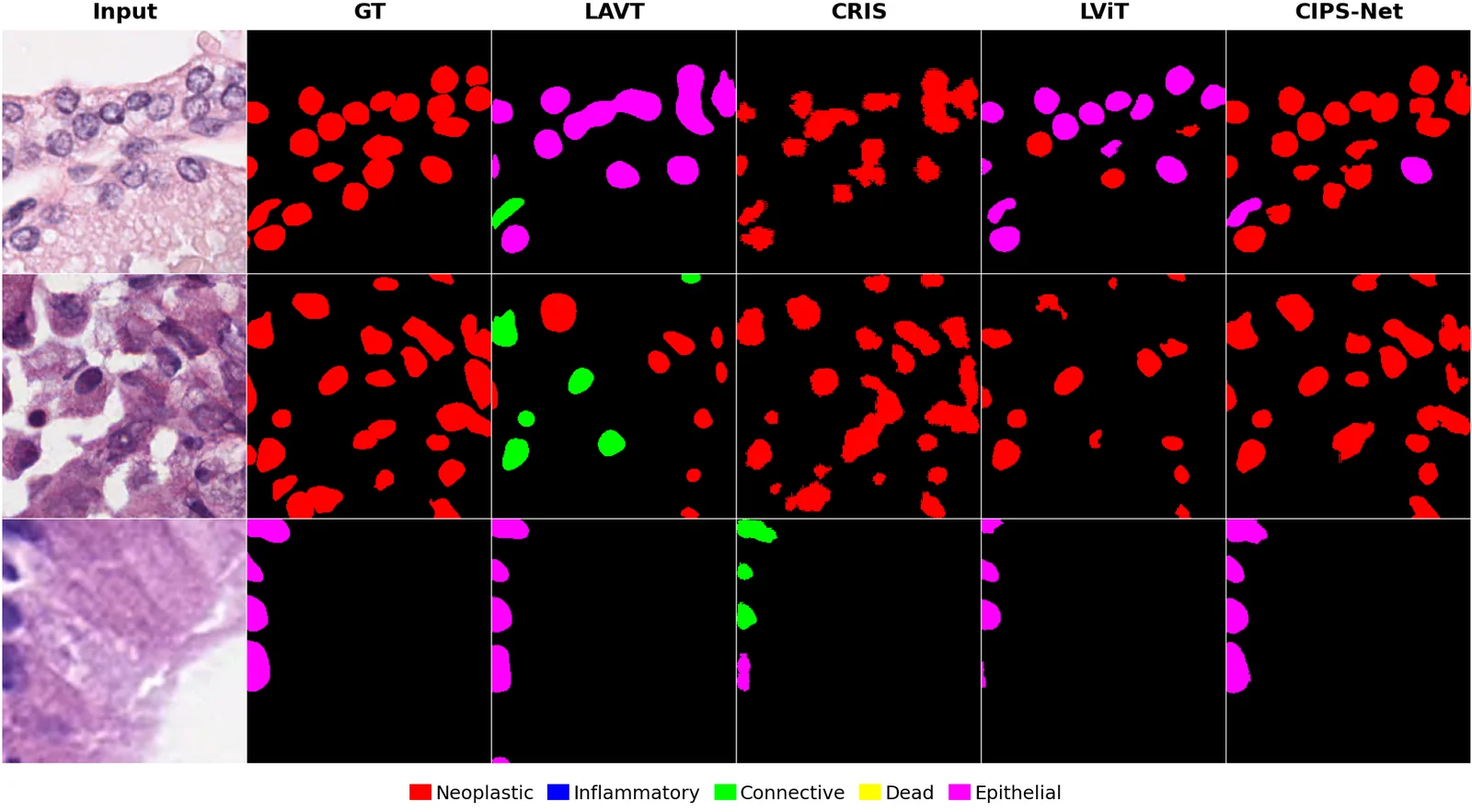 CIPS-Net qualitative segmentation results across tissue types